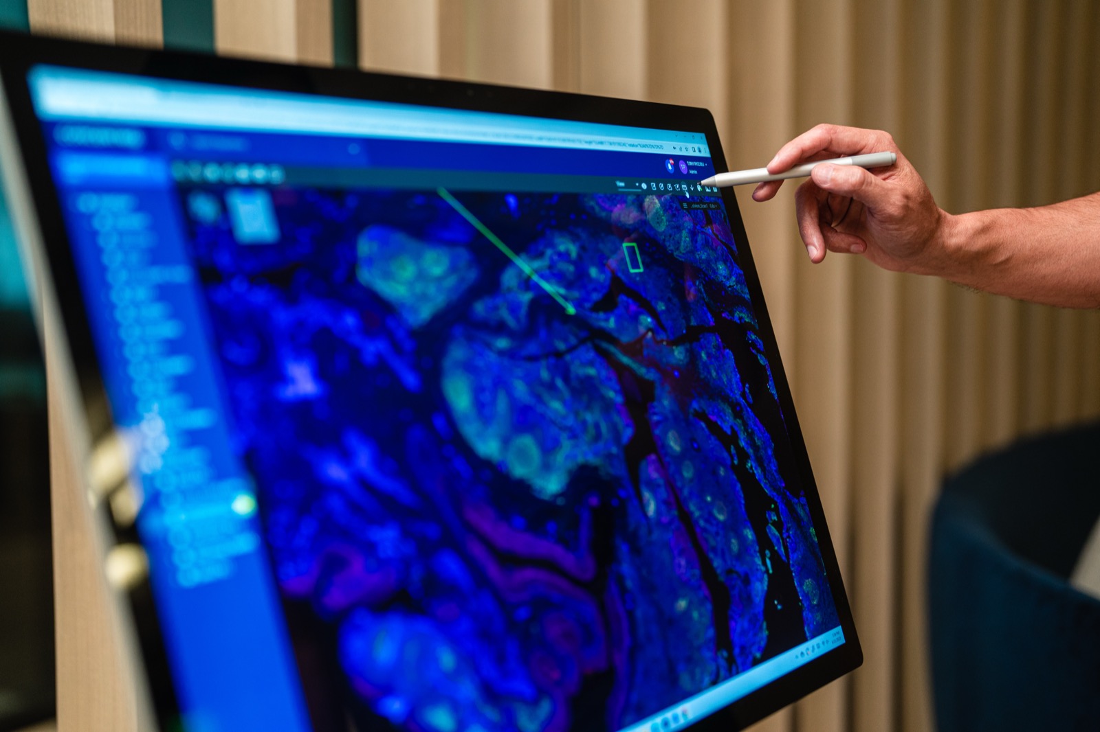 A colleague at Proscia, the company David West founded, reviewing a digital pathology scan